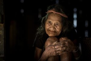 わきが治療を大阪で受ける際のおすすめクリニックは？